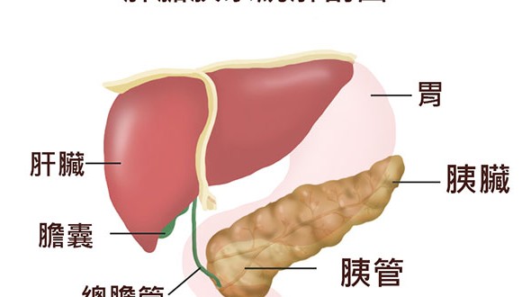 胰臟癌