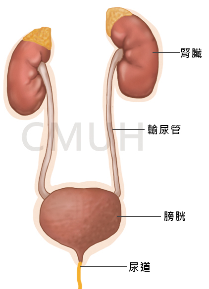 膀胱輸尿管逆流