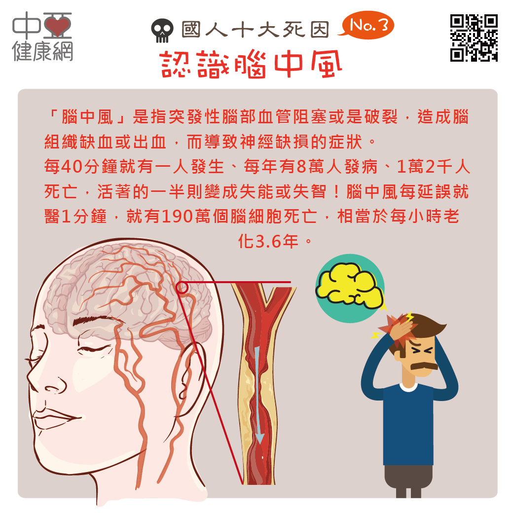 腦中風