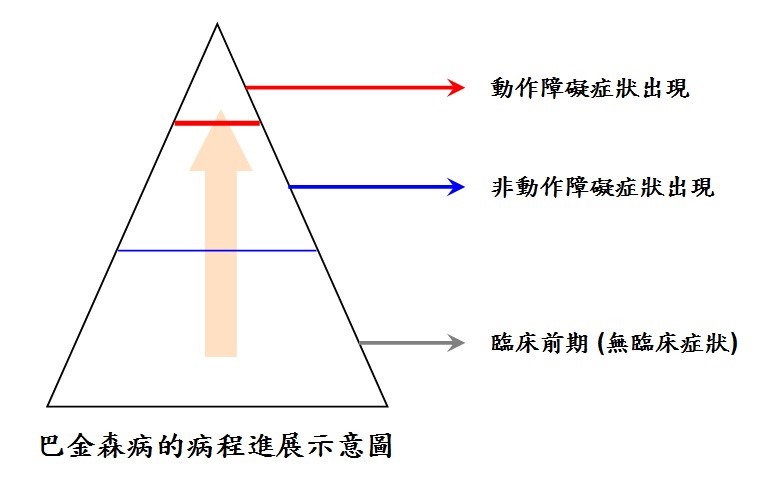 巴金森病的病程