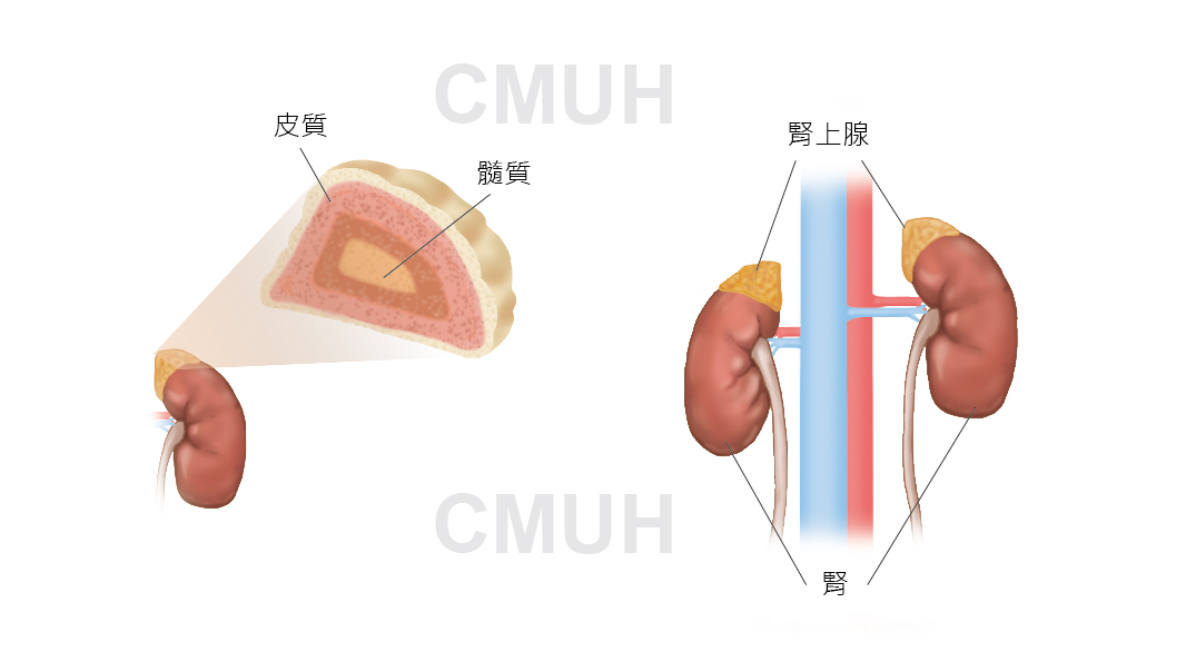 原發性皮質醛酮症