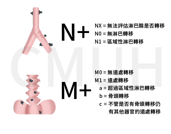 攝護腺癌