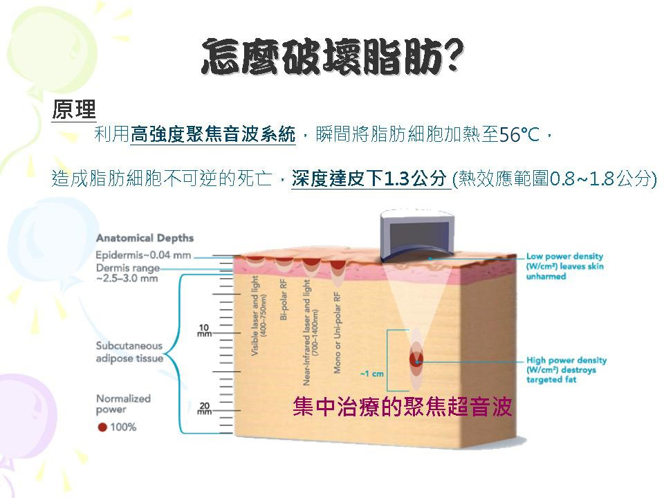 liposonix立塑超聲波溶脂