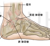 腳踝扭傷的治療與保健