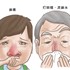 冬病夏治三伏天灸療