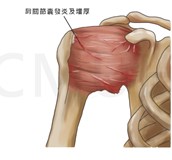 五十肩運動治療及注意事項