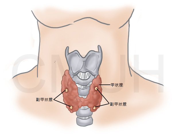 甲狀腺亢進