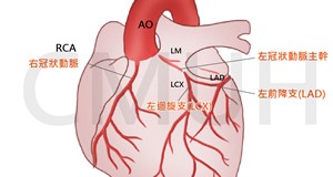 核子醫學掃描