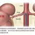 經腎動脈自主神經阻斷術治療頑固型高血壓