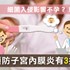 子宮內膜炎