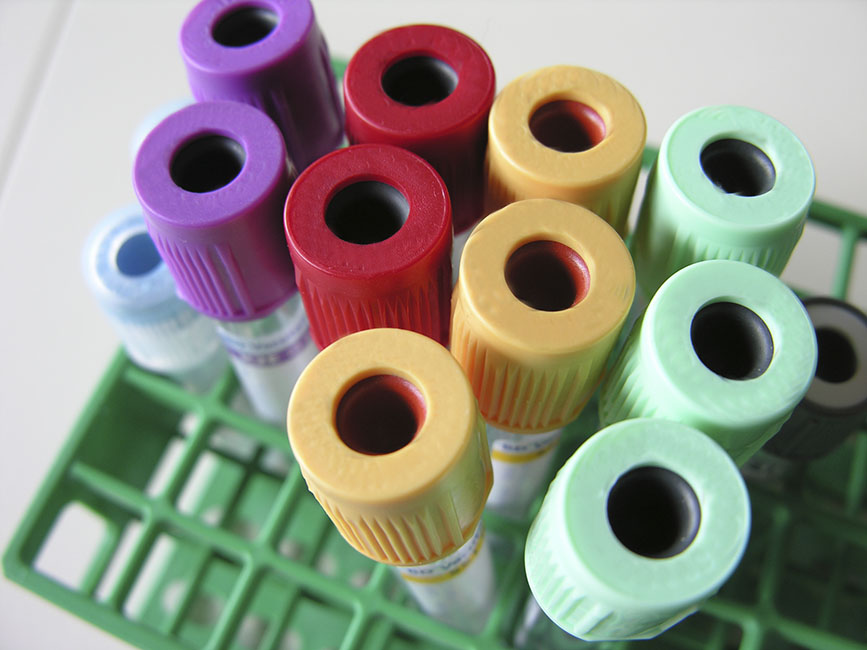 卵巢癌CA125指數