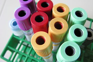 卵巢癌CA125指數