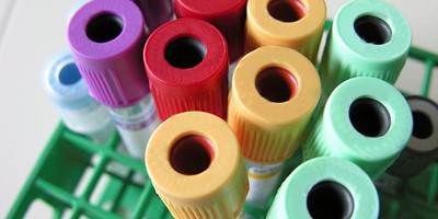 卵巢癌CA125指數