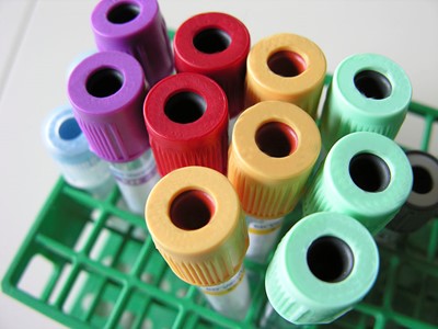 卵巢癌CA125指數