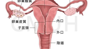 子宮內膜癌