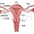 子宮內膜癌