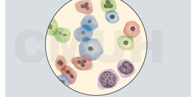 子宮頸細胞化生不良與上皮內腫瘤