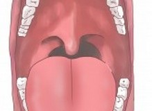 口腔老化