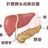 何謂糖尿病