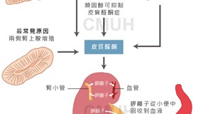 原發性皮質醛酮症