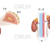原發性皮質醛酮過多症
