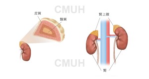 原發性皮質醛酮過多症