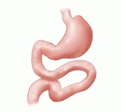 腹腔鏡胃繞道手術