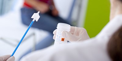 子宮頸抹片檢查