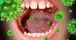 類風濕關節炎與牙周病之關聯