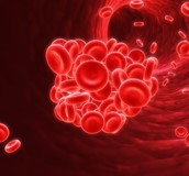 中大腦動脈狹窄阻塞治療最新進展