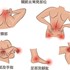 自體脂肪幹細胞搶救退化性關節炎