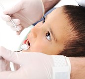 氟在預防齲齒上的功效