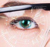 青光眼的特殊遺傳變異