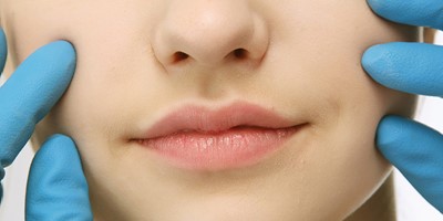 口腔癌之症狀、預防與自我檢查