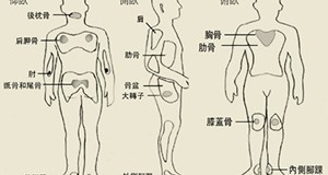 壓瘡的預防與治療