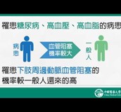 【影音】雷射輔助下肢周邊動脈血管成型術