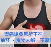 早期胃癌療效佳  出現警訊莫輕忽