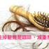 年輕女性掉髮 缺鐵常是主因