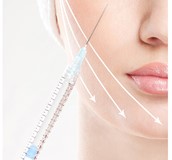 肉毒桿菌素注射