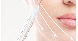 肉毒桿菌素注射