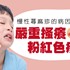 慢性蕁麻疹患者看過來！