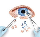 如果從此視茫茫… 小心視網膜剝離