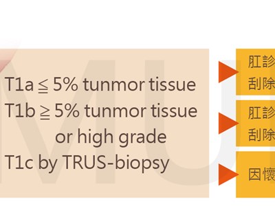 攝護腺癌於治療前之評估