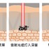 銣雅鉻雷射除斑