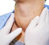 射頻消融術 微創縮小甲狀腺結節