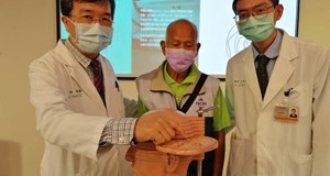 治療原發性震顫不用開刀 神波刀讓八旬伯不再為手抖所苦