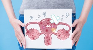 經陰道自然孔洞內視鏡手術進行子宮切除術