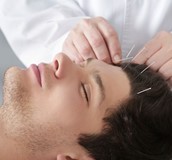 針灸扶一把 中風復原之路更好走