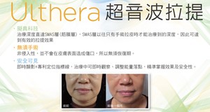 Ulthera™ 極線音波拉提