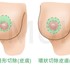提乳手術